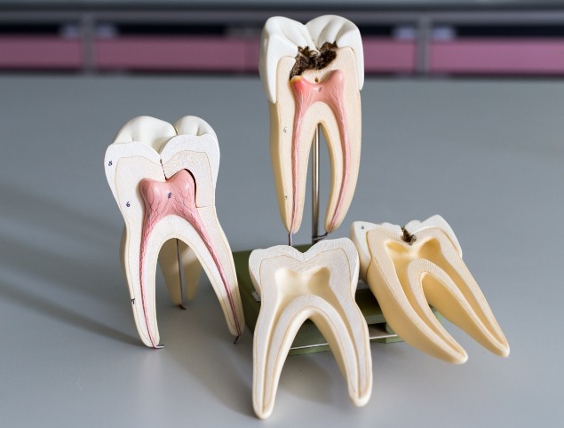 Several models of teeth on desk showing inner layers of tooth